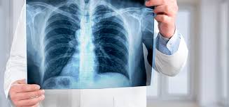 Types of X-Ray Machines: Fixed, Mobile & Portable | Medical & Industrial Applications